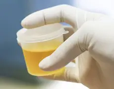 Ciência revela o motivo que faz urina ficar amarela