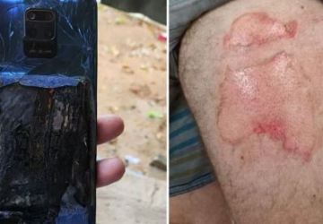 Celular explode dentro do bolso e homem tem a perna queimada