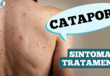 Dr. Ajuda: qual a relação da catapora com o herpes Zoster?