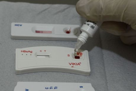 SP tem 30 mil cadastrados para profilaxia pré-exposição ao HIV