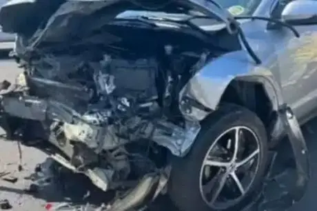 Famosa atriz e sua mãe sofrem acidente de carro no RJ